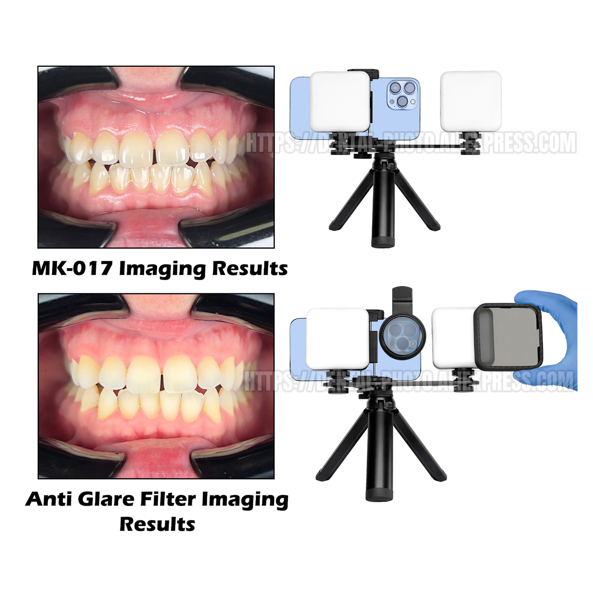HERA Cep Telefonu Fotoğrafçılı - Photography Mobile Lighting incelemesi ve fiyatı